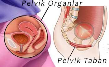 Pelvik Taban Düşüklüğü basurum