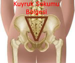 pilonidal sinus, kıl dönmesi basurum