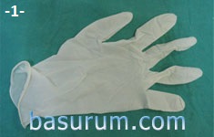 Sıcak uygulama basurum Sıcak uygulama basurum