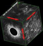 Endoanal Ultrason Apse basurum