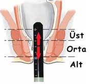 Endoanbal Ultrasonm 3D