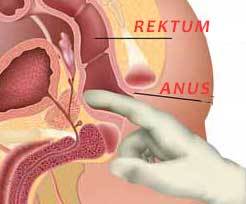 Endoanal Ultrason basurum