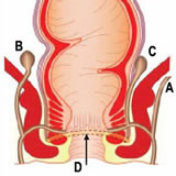 Perianal Fistül Atnalı basurum