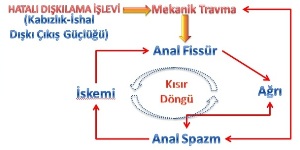 Anal Fissürde Ağrı Spazm döngüsü Anal Fissür Ağrı Spazm basurum