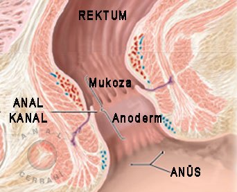 Anal kanal anoderm Anal kanal anoderm