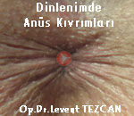 Dinlenimde anüs kıvrımları, akordiyon Dinlenimde anüs kıvrımları, akordiyon